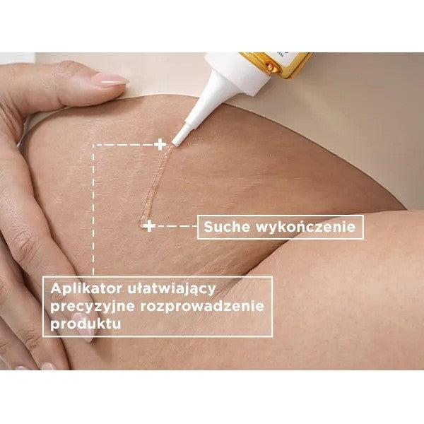MIXA Niacinamide Bright olejek na rozstępy z kwasami omega 6 i omega 9 z oleju słonecznikowego 100ml